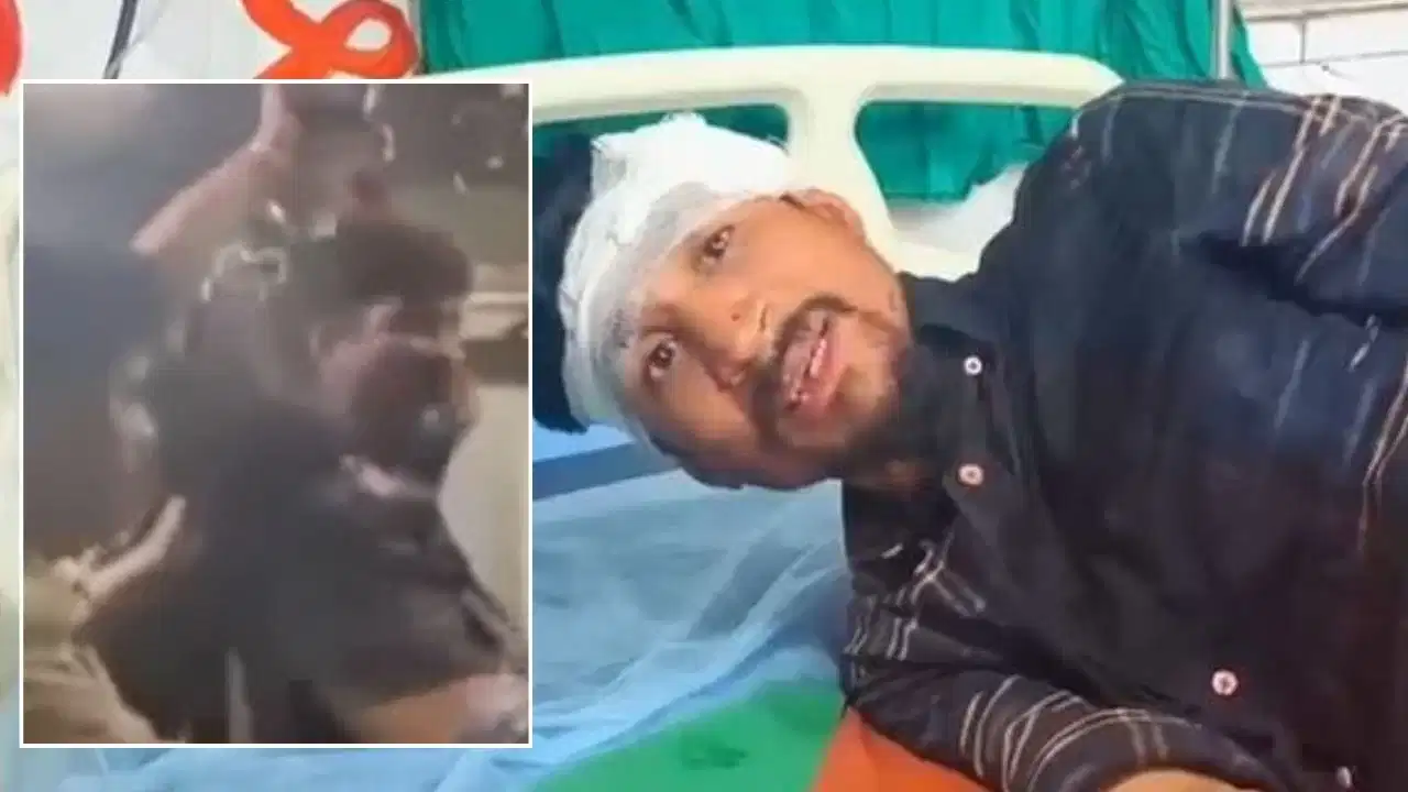 मुंबई लोकल में फिर खूनी संघर्ष! यात्री पर कड़े से हमला, सिर फूटा; पीड़ित बोला- ‘चलती ट्रेन से फेंकने की कोशिश की’