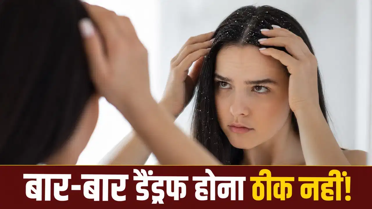 डैंड्रफ सिर्फ गंदगी नहीं, इन वजहों से भी हो सकती है सिर में रूसी डैंड्रफ सिर्फ गंदगी नहीं, इन वजहों से भी हो सकती है सिर में रूसी