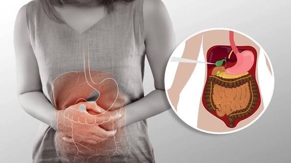 Gallbladder Stones: पित्त की थैली में कैसे बनती है पथरी? जानें लक्षण और इलाज Gallbladder Stones: पित्त की थैली में कैसे बनती है पथरी? जानें लक्षण और इलाज